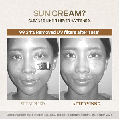 VINNE Signature Milky Foam Cleanser – 3-Step Milk-Oil-Foam Korean Facial Cleanser w/LHA+PHA & 17 Active Ingredients – Oil & Water-Based Dual-Action Face Wash (4.05 fl. oz)