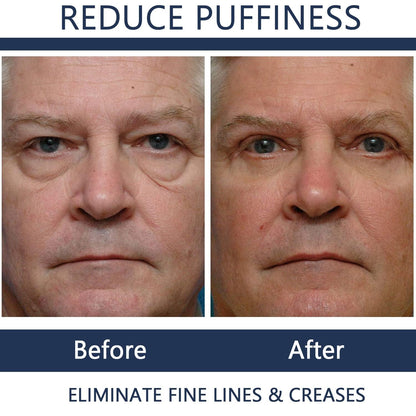 Men Eye Cream Anti Aging,Himse Awaken Peptide Depuffing Eye Gel,Men's Moisturizing Eye Cream Remove Eye Bags,Wrinkles,Fine Lines,Dark Circles,Puffiness and Bags Under Eyes (2PCS)