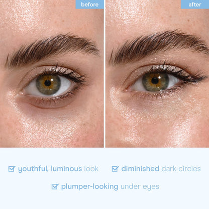 Baebody Advanced Snail Mucin Under Eye Masks (6 Pairs), Under Eye Patches for Puffy Eyes and Dark Circles, Hydrating Under Eye Patches to Reduce Fine Lines, Under Eye Patches Korean Inspired