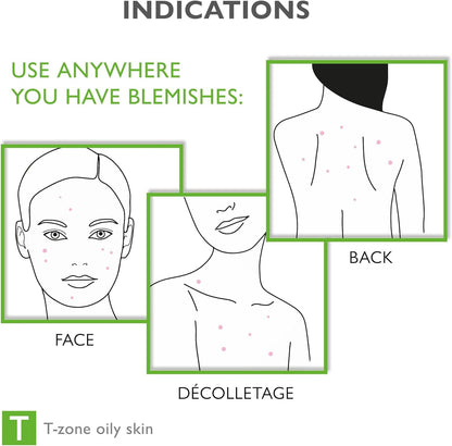 Face & Body Breakout Solution - 3% Mandelic Acid Helps Clarify Blemish & Acne Prone Skin, Face, Back & Chest Pimples Exfoliating & Clearing Treatment, SEBO-ALMOND-CLARIS, 6.42 fl oz