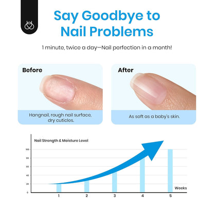 Beetles Cuticle Serum for Nail 20ml Nail Care Cuticle Repair Oil with Jojoba Oil & Vitamin E Nail Growth Remedy for Damaged Skin & Thin Nails Spa and Hand Manicure Essentials Gift For Women Girls