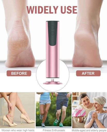 Electric Foot Callus Remover & Nail Drill - 2 in 1 Rechargeable Foot File Grinder Nail Polish Remover - 6 Speed Pedicure Tool Dead Skin Remover for Dry Cracked Feet - Grater Buffer for Feet for Women