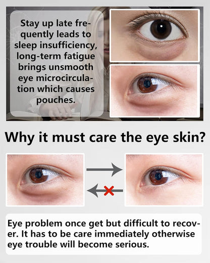 Under Eye Patches (60Pcs) - Upgraded Eye Mask Black Pearl & Collagen, Eye Treatment Mask, Under Eye Bag Treatment, Eye Mask for Puffy Eyes, Anti-Aging, Anti-Wrinkle, Fine Lines, Under eye Dark Circles