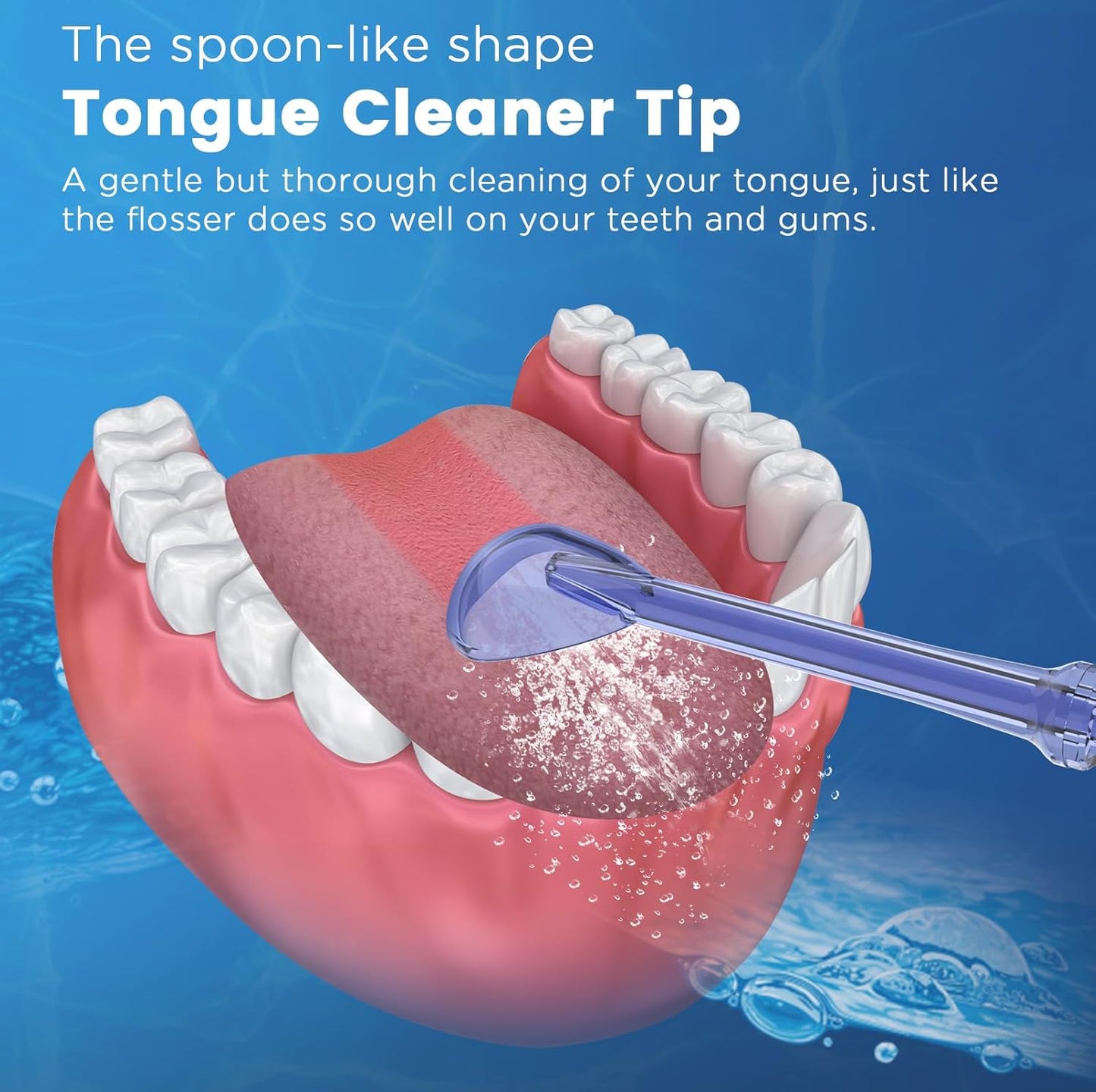 Replacement Tips for Waterpik, Water Flosser Replacement Heads Parts for Waterpik Oral Irrigator (Aquaflosser 6 Tips Tongue Combo & Storage Case Bundle)