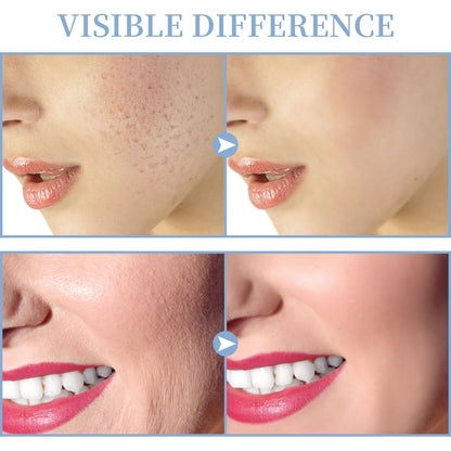 High Frequency Facial Machine - TUMAKOU Portable Handheld High Frequency Facial Skin Wand Machine with 4 Different Tubes