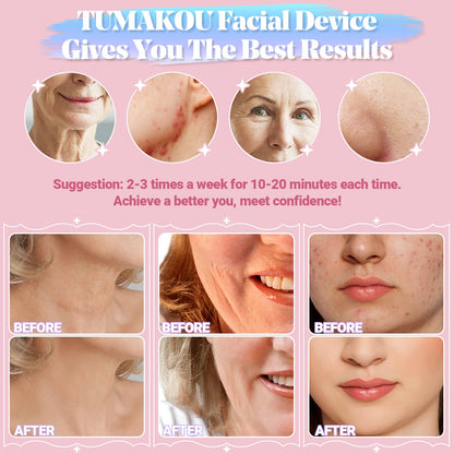 High Frequency Facial Machine - TUMAKOU Portable Handheld High Frequency Wand with 6 Pcs Violet Tubes for Face Home Use Device