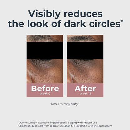 Eucerin Radiant Tone Eye Cream Dark Circle Corrector, Eye Brightening Cream with Thiamidol and Hyaluronic Acid, Helps Reduce the Look of Eye Puffiness, 0.5 Oz Tube