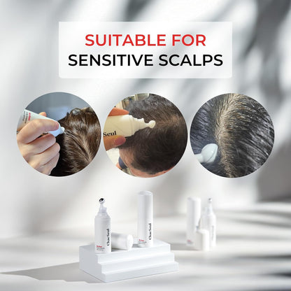 Revhan Scalp Serum for Hair Loss & Thinning – Hair Growth Serum for Men & Women w/Salicylic Acid & Centella Asiatica – Soothes Itchy, Irritated Scalp with Roll-On