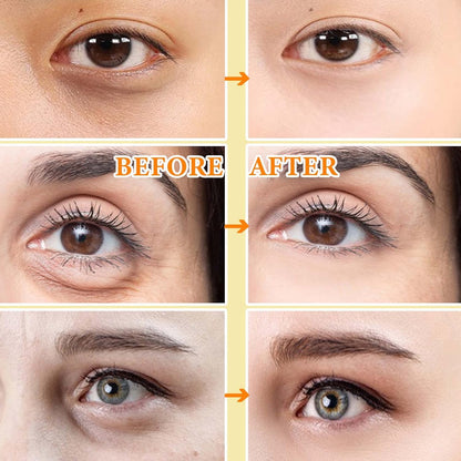 30 Pairs Gold Eye Mask,Under Eye Patches for Dark Circles and Puffiness,Reduces Eye Bags and Smoothes Frownies,Improves Eye Skin Elasticity,Eye Treatment Patches,Skin Care Products