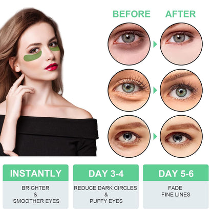 Aloe Vera Eye Mask, 60 Pcs Under Eye Patches, Eye Treatment Mask for Under Eye Bags, Dark Circles, Puffy Eyes, Fine Lines, Anti-Aging and Anti-Wrinkle, Hydrating Eye Mask Skincare