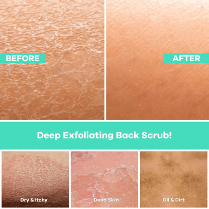 Dermasuri Deep Exfoliating Back Scrubber -Bath & Shower Back Scrub - Body Exfoliator Scraper Tool - Deep Exfoliation Body Cleaner for Shower, 27" Long, 8" Wide