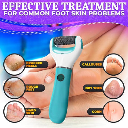 Electric foot callus remover -