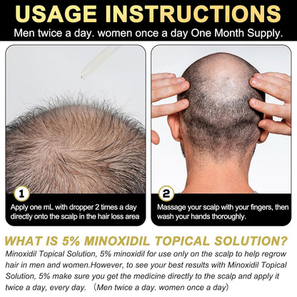 5% Minoxidil for Men and Women Hair Growth Serum, Biotin Hair Growth, Hair Regrowth Treatment for Scalp Hair Loss Hair Thinning for Thicker Longer Fuller Healthier Hair (Pack of 2)