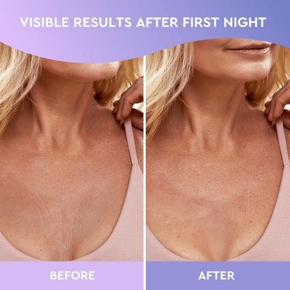 CLEVERFY Silicone Chest Wrinkle Pads Sleeping Reusable (2 Pack T-shape) - Silicone Decollete Anti Wrinkle Chest Pads - Anti Wrinkle Patches for Decollete Wrinkle Prevention