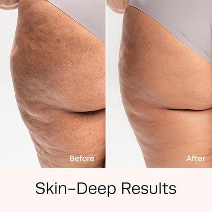 Hot Vita Retinol Body Toner - Nighttime Anti-Aging & Anti-Cellulite Formula to Tighten Skin, Smooth Complexion, & Enhance Radiance - Body Serum for Women - Made with Natural, Skin-Safe Ingredients