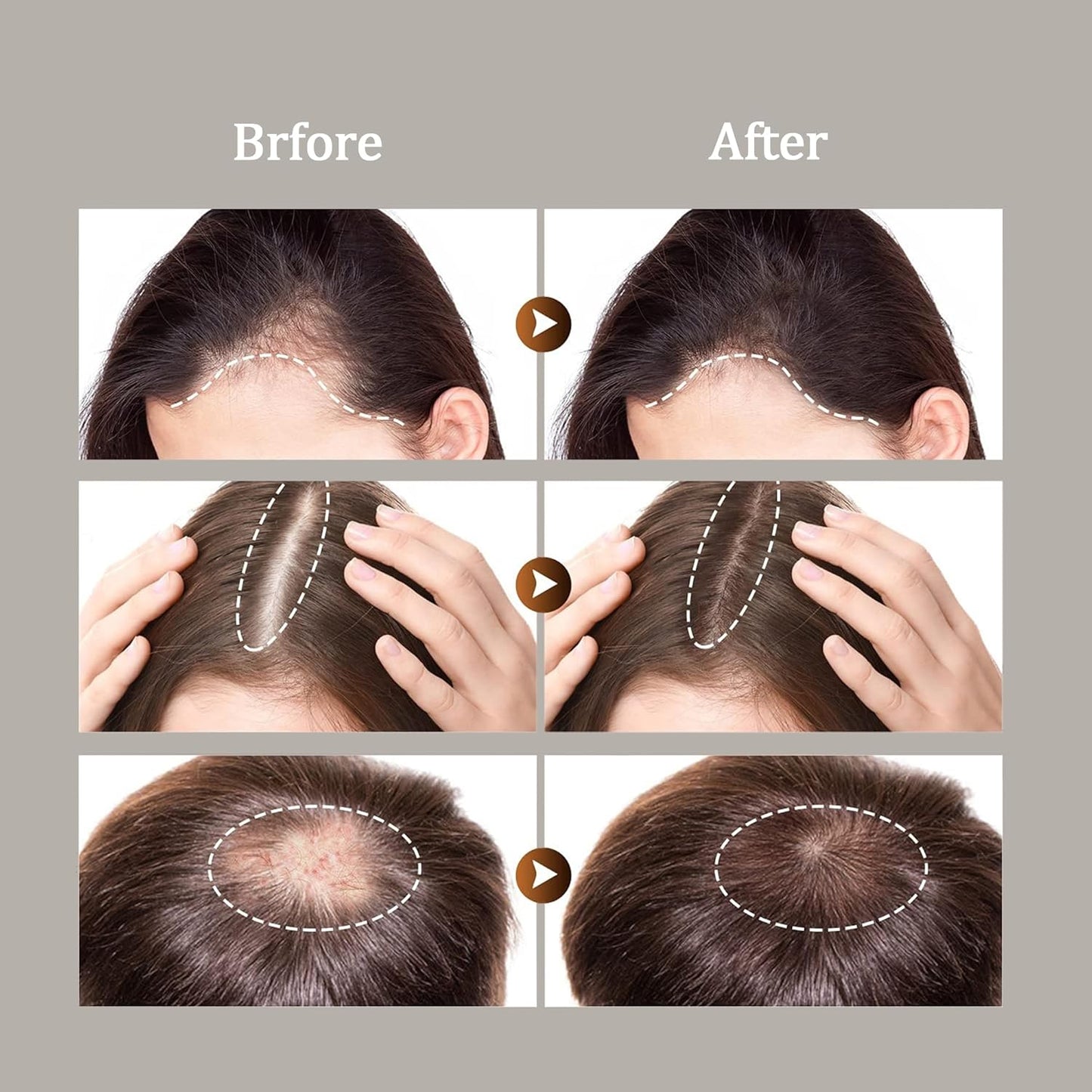 Dr.Healdy Batana Oil Conditioner for Hair Growth - Repairs Damage, Nourishes Scalp & Strengthens Hair Roots - Sulfate Free Formula for All Hair Types (6.8 Fl Oz)