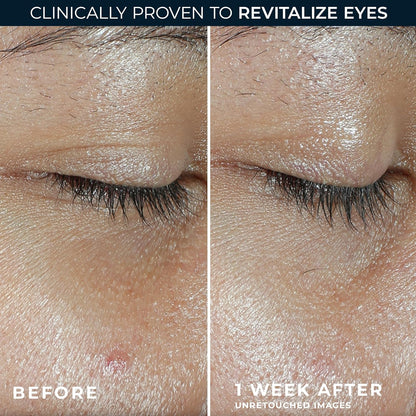 RoC Multi Correxion Revive + Glow Eye Balm with Vitamin C (0.14 oz) + Retinol Eye Cream Packette