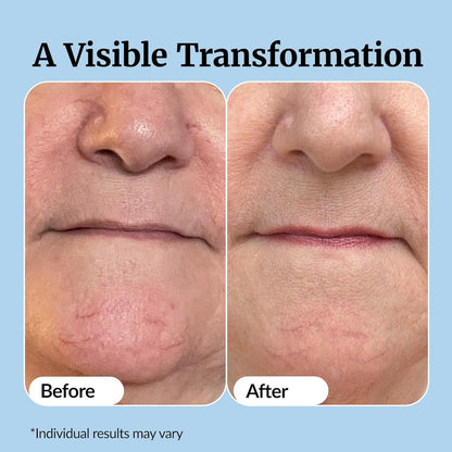 Vibriance Super C Serum for Mature Skin - All-in-One Vitamin Formula Hydrates, Firms, Lifts, Smooths, Targets Age Spots, Wrinkles, 1 fl oz - Pack of 2