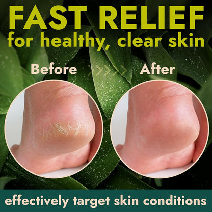 Terramed Just Think Comfort Foot Balm for Dry Cracked Feet | Foot Balm Stick for Dry Cracked Feet Tough Skin on The Heels and Intensely Moisturizing | No Mess Applicator | 2 Pack Stick