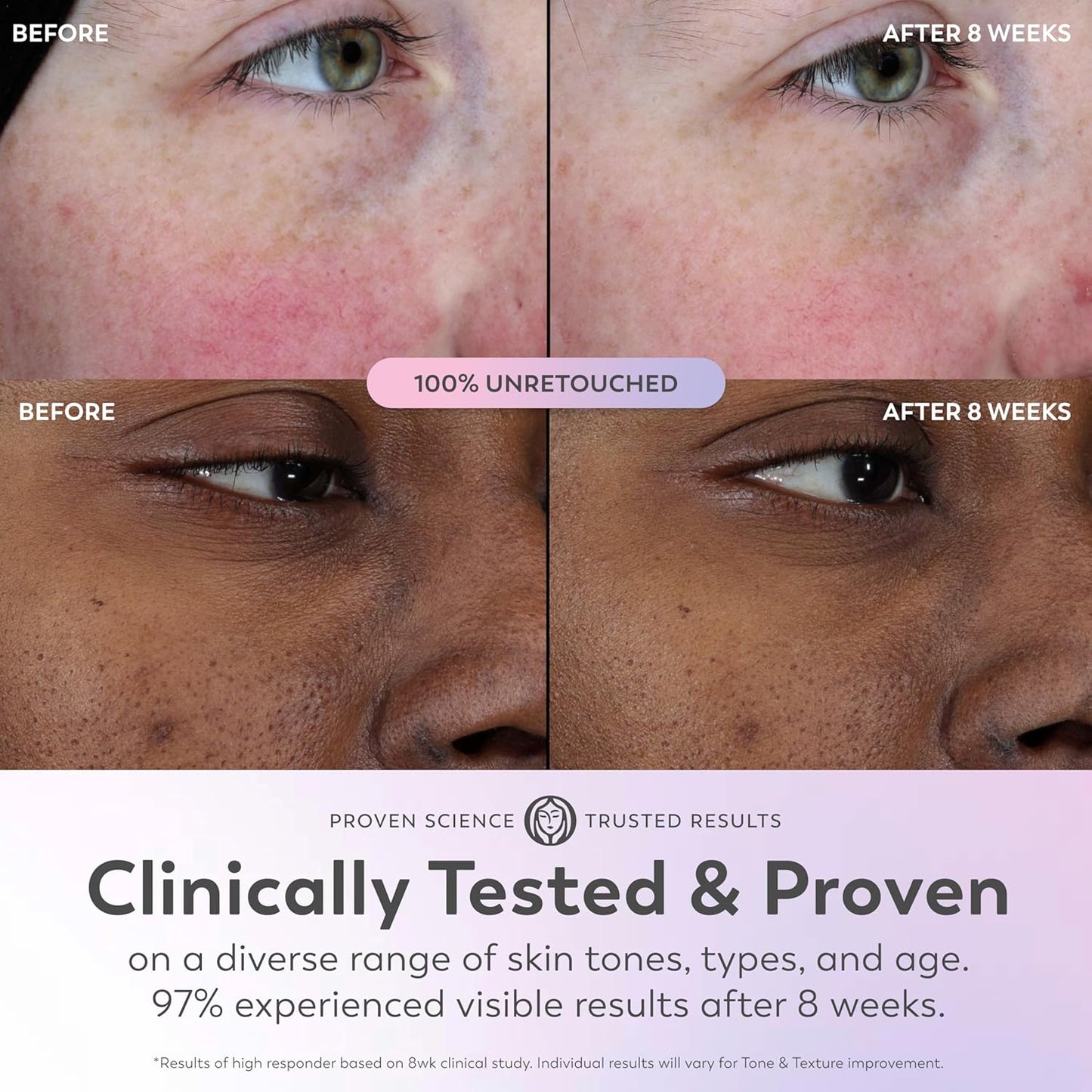 Olay Super Serum - Niacinamide, Vitamin C & E, Collagen Peptide, AHA - 5-in-1 Skin Care Benefits for Face - Healthy Glow, Brightening, Hydrating, Smoothing, Firming, Evens Tone, Anti-Aging, 1.7 Oz