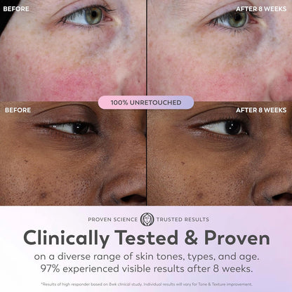 Olay Super Serum - Niacinamide, Vitamin C & E, Collagen Peptide, AHA - 5-in-1 Skin Care Benefits for Face - Healthy Glow, Brightening, Hydrating, Smoothing, Firming, Evens Tone, Anti-Aging, 1.7 Oz