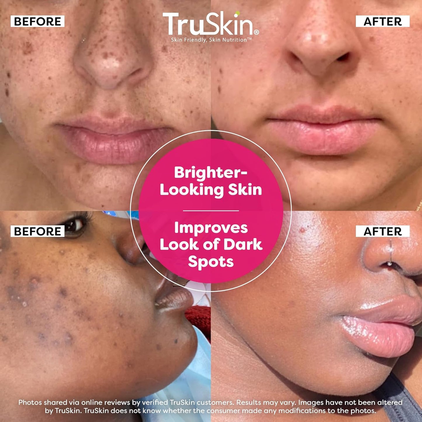 TruSkin Vitamin C Super Serum - Niacinamide, Retinol, Hyaluronic & Salicylic Acid - All-in-One Anti Aging Serum for Face – Improve Appearance of Dark Spots, Firmness for Brighter Looking Skin, 1 Fl Oz