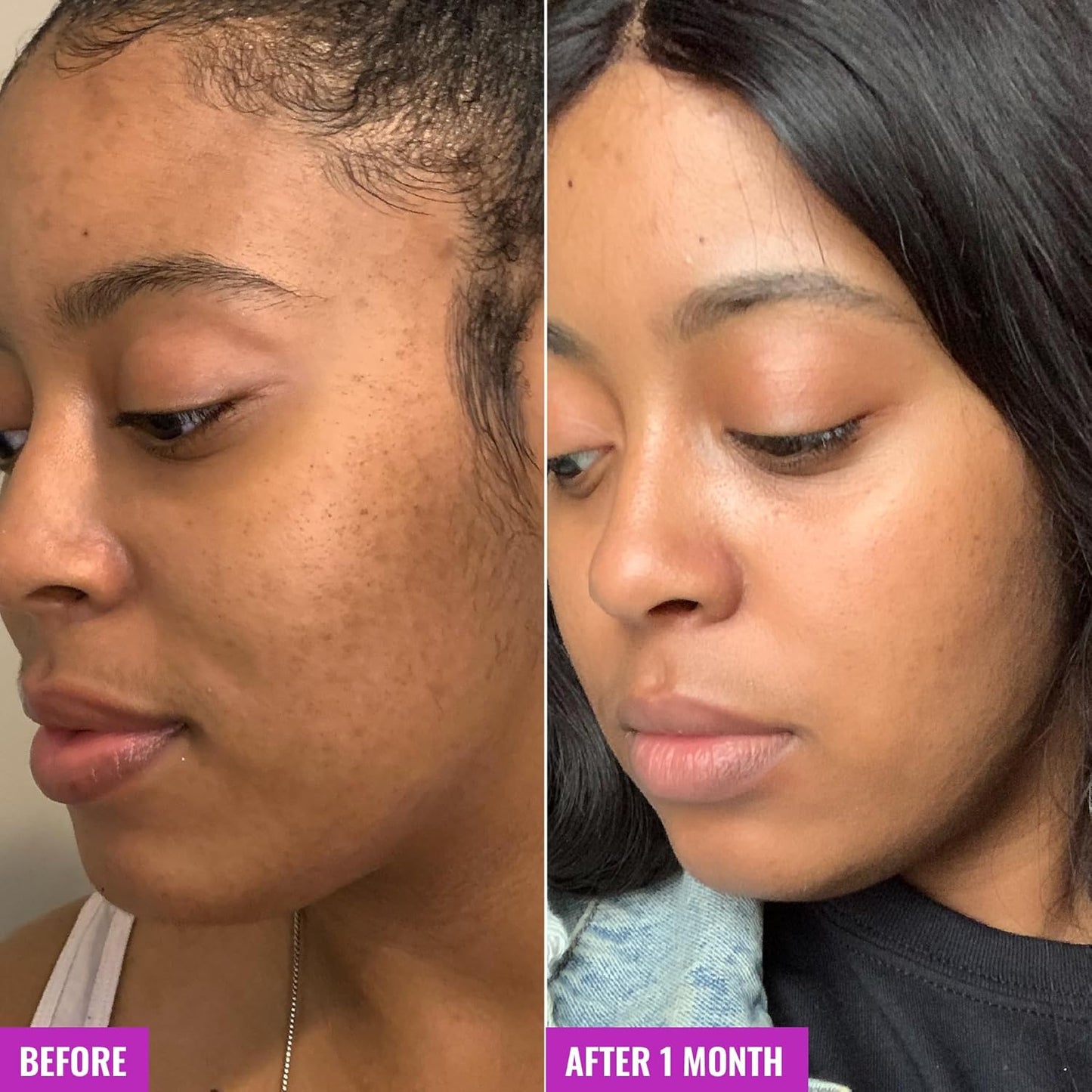 Good Molecules Glycolic Exfoliating Toner - Hyaluronic and Glycolic Acid Daily Toner for Face - Cleansing Facial Exfoliant for Glowing Even Skin Tone, Skin Care