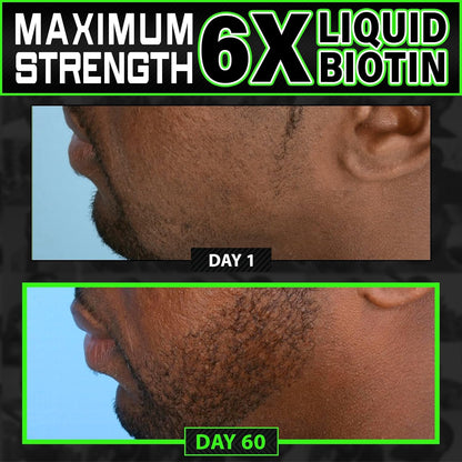 Liquid Biotin Collagen Peptides for Beard Growth and Thickening - Men's Beard and Hair Growth Supplement - Biotin Liquid Drops 96,000mcg 6X More Absorption