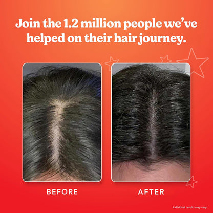 HAIRtamin Scalp Serum Natural Hair Growth Thickening | Made in USA | Helps Increase Hair Thickness and Aids Against Hair Thinning and Hair Fall Out | Moisturizes and Soothes Dry Itchy Scalp