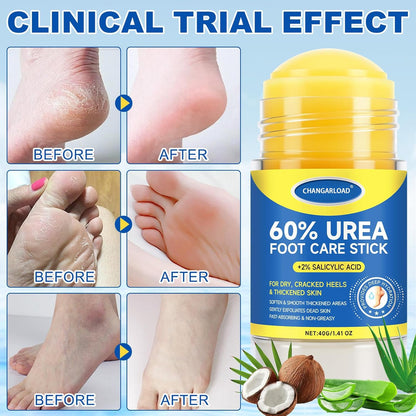 60% Urea + 2% Salicylic Acid Foot Cream–Ultra-Moisturizing Formula, Exfoliates Dead Skin, Softens Dry, Cracked Skin on Feet, Knees, Hands, Elbows. Helps soften callused, rough, or tender areas 2.82oz