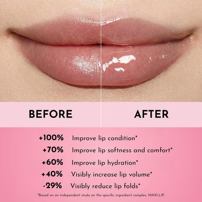 Lawless Women's Forget The Filler Lip Plumper Line Gloss, Rosy Outlook, Pink, 0.11 Fl Oz (Pack of 1)