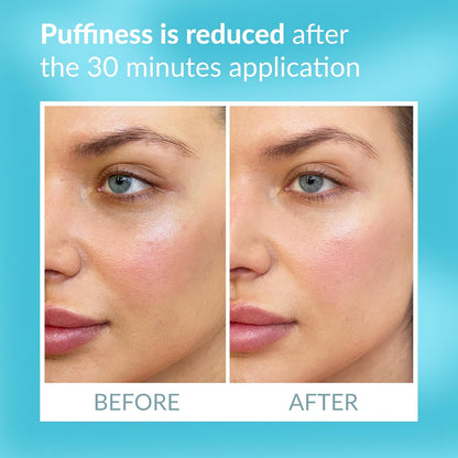 Talika Eye Therapy Patch - Instant Smoothing Under Eye Patches - For Dark Circles Puffiness & Tired Eyes - Reusable Under Eye Patch Skincare Eye Treatment