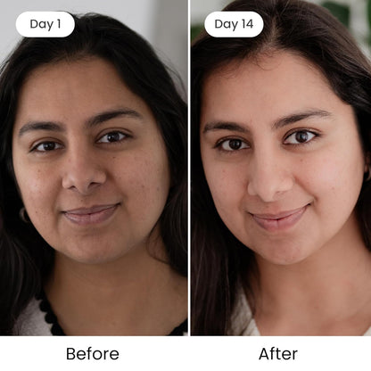 Shankara Kumkumadi Oil with Pure Saffron and Ayurvedic Herbs (Rose Aroma 18ml)