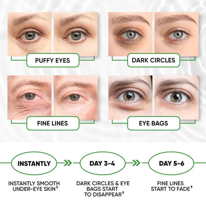 Under Eye Mask for Puffy Eyes, Dark Circles, Eye Bags, Puffiness, Wrinkles with Collagen - Hydrating - Green Tea Skincare - Anti-Aging Eye Patch Treatment Masks - 60 Under Eye Gel Pads