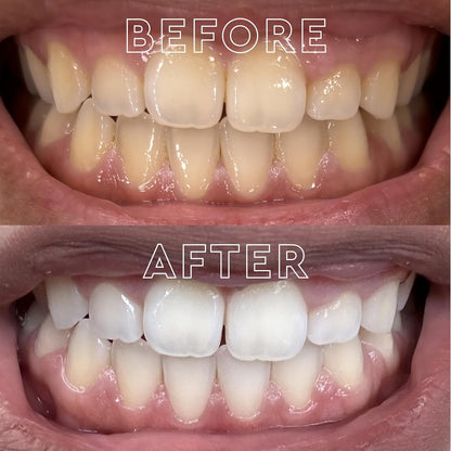 MOON Dissolving Teeth Whitening Strips - Vegan, Easy-to-Use White Strips - Dissolve in 15 Minutes & Designed to Gently Whiten Sensitive Teeth Up to 7 Shades in 2 Weeks, Midnight Mint (56 Count)