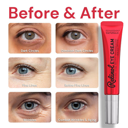 Premium Eye Cream for Anti Wrinkles: Retinol Under Eye Cream for Dark Circles and Puffiness, Advanced Formula Eye Cream with Collagen & Peptide