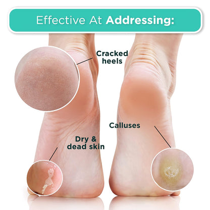 DERMORA Foot Peel Mask | Skin Exfoliating Foot Masks | Dry, Cracked Feet, Callus, Dead Skin Remover | Baby Soft Feet | Original Scent | Pack of 4 | Regular