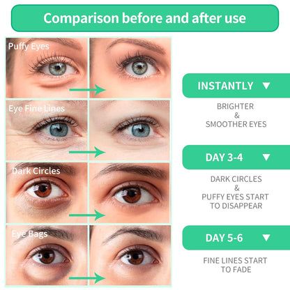 BREYLEE Aloe Vera Eye Masks 60 Pcs-eye Masks with Calming and Hydrating Ingredients, Improve and Firm eye Skin,Under Eye Patches,Eye Patches For Puffy Eyes,Multiple Plant Essences