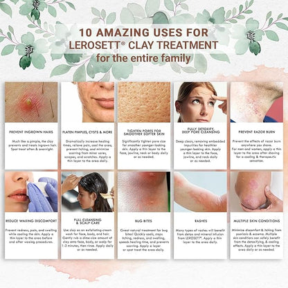 Lerosett facial clay for acne,