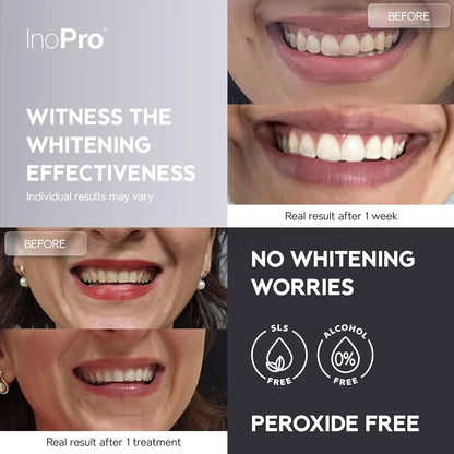 Natural Teeth Whitening Strips Kit 14 Treatments - Sensitive Teeth Whitener, Peroxide Free with Papain, Bromelain, Coconut Oil, White Strips for Teeth Whitening (28 Strips)
