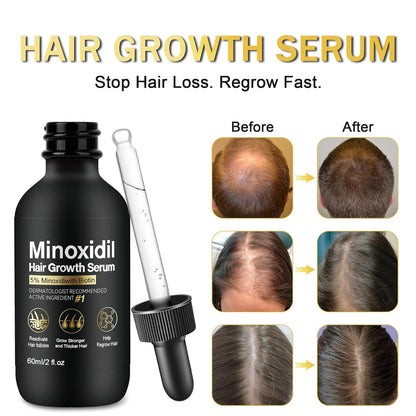 5% Minoxidil for Men and Women Hair Growth Treatment,Topical Minoxidil for Beard Growth, Hair Regrowth Serum for Scalp Hair Loss and Thinning, with Biotin (3Pack)