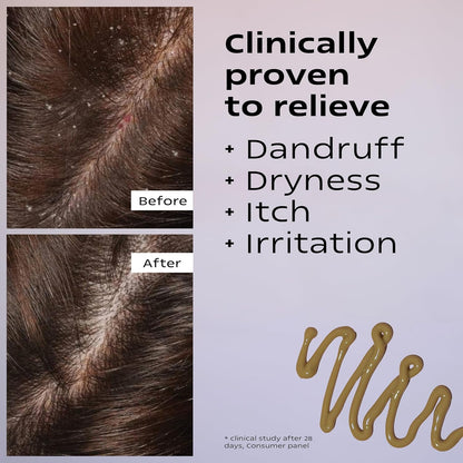 KAMEDIS Scalp Moisturizer Lotion For Dry, Itchy, Dandruff, Flaky, Seborrheic Dermatitis, Psoriasis and Sensitive Scalp. Over-Night Mask Treatment Botanicals-Based. Parabens Free. 3.38 Fl Oz.