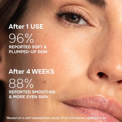 SimplyVital Collagen, Retinol & Hyaluronic Acid Serum - Moisturizer for Face, Neck & Décolleté – Lightweight Hydration for Daily Care – Made in USA – Hyaluronic Acid Cream – 1 fl.oz