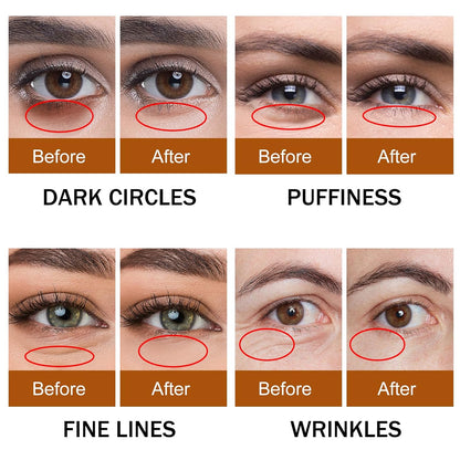Birthday Gifts for Women,Dark Circles Under Eye Treatment For Puffiness And Bags Under Eyes Wrinkles Dark Circles,Eye Care,Skin Care,Caffeine Eye Serum,Eye Bag Remover Puffy Eyes Treatment Products