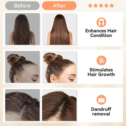 HEETA Scalp Massager Hair Growth, Soft Silicone Scalp Scrubber Shampoo Brush for Exfoliation, Dandruff Removal Head Massage Stress Relax, Wet & Dry Use for Thick Thin Curly Hair Care, Gradient Pink