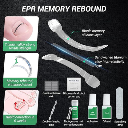 Titanium alloy ingrown toenail treatment