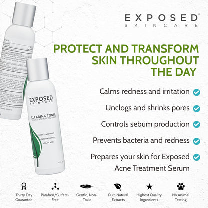 Exposed Skin Care Clearing Tonic Facial Toner with 1% Salicylic Acid and Witch Hazel for Acne Treatment – Pore Minimizing Toner to Prevent Breakouts, Reduce Redness and Balance Skin – Step 2 (4 fl oz)