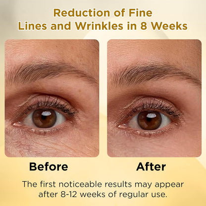 LADY NADA Retinol Eye Serum – Anti-Aging Night Treatment with Collagen, Vitamin E & Natural Extracts – Smooths Fine Lines, Deeply Hydrates, Long-Lasting Effect – For All Skin Types – 1.0 fl oz