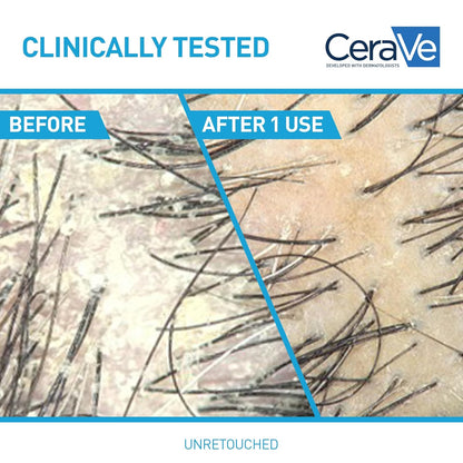 CeraVe Hydrating Anti Dandruff Shampoo, 1% Pyrithione Zinc Dandruff Treatment With Ceramides, Niacinamide & Hyaluronic Acid, Helps Eliminate Flakes & Provides Itchy Scalp Relief, Sulfate Free, 12 Oz