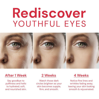 Retinol Eye Cream for Anti-Aging: Hydrating Under Eye Cream with Collagen - Lifting & Tightening Treatment for Fine Lines Smoothing, Reduces Wrinkles, Dark Circles, and Puffiness in 4 Weeks | 25 ml